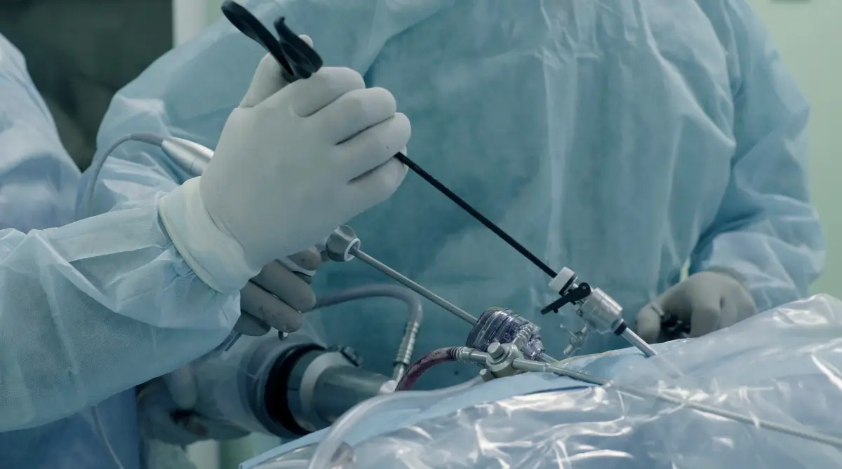 Hernia abdominal